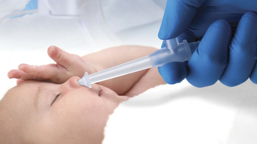 Babys Nase wird mit LittelSucker Nasal-Tip abgesaugt