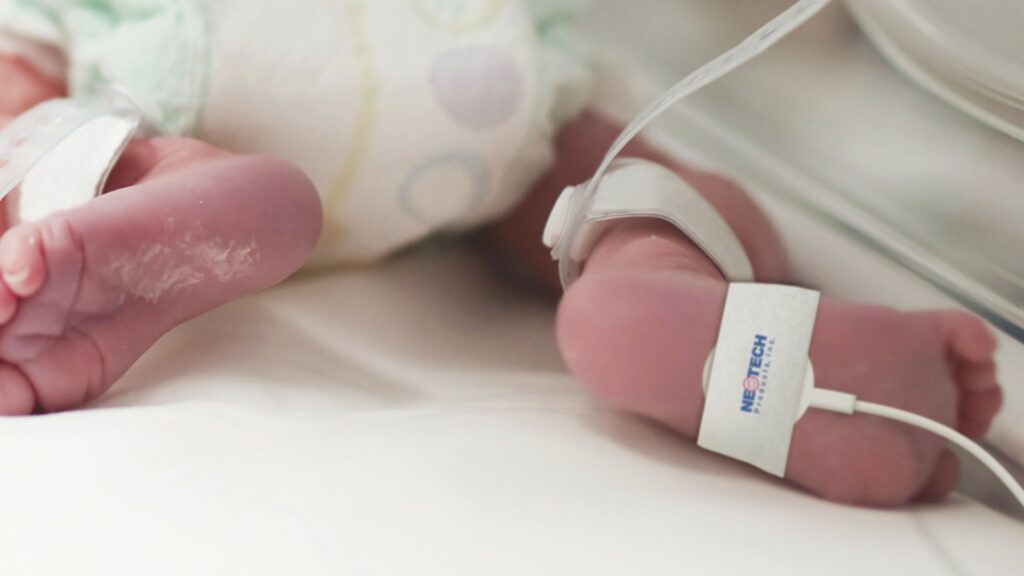 Baby liegt auf dem Bauch. An einem Fuss wurde der SpO2 Sensor mit NeoPulse fixiert.