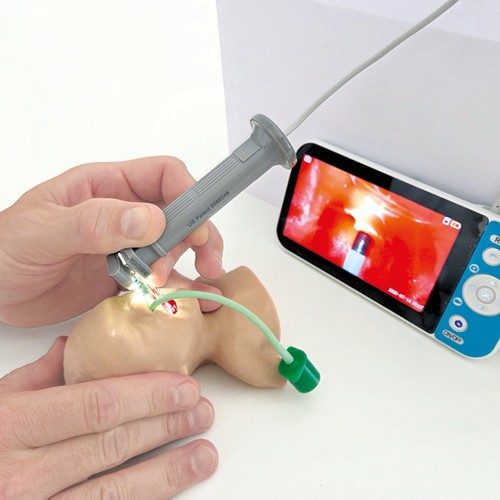 Galeriebild Intubation mit Ben
