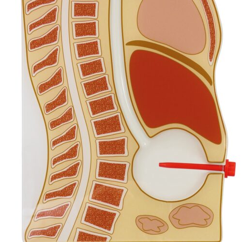 Stoma Plug Set